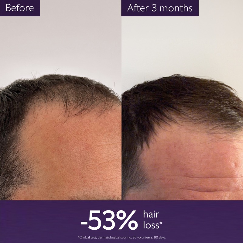 CAUDALIE Anti-Hair Loss Serum CAUDALIE Anti-Hair Loss Serum